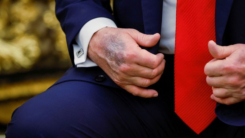 Sanewashing: Medienberichterstattung über Trump