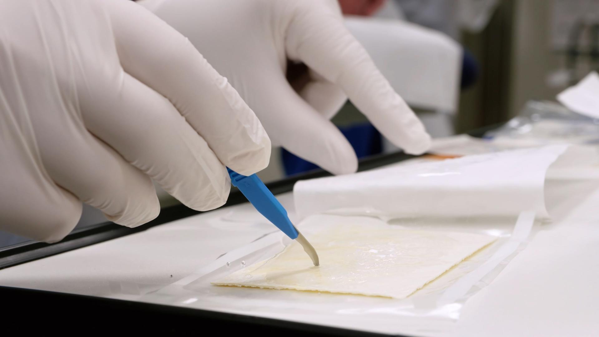 Kompartmentsyndrom: Ursachen, Erkennung und Behandlung