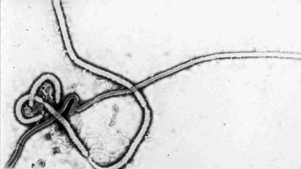 Warum ist das Ebolavirus so tödlich?