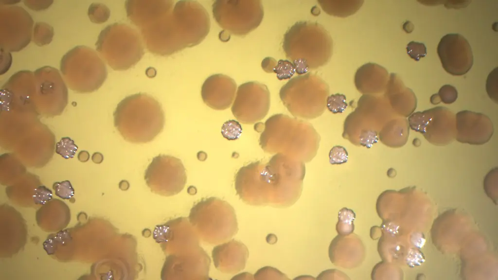 Forschung klärt extreme Antibiotika-Resistenzen auf