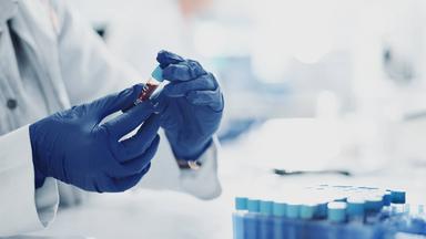 Herausforderungen und Langzeitfolgen von Sepsis in Deutschland