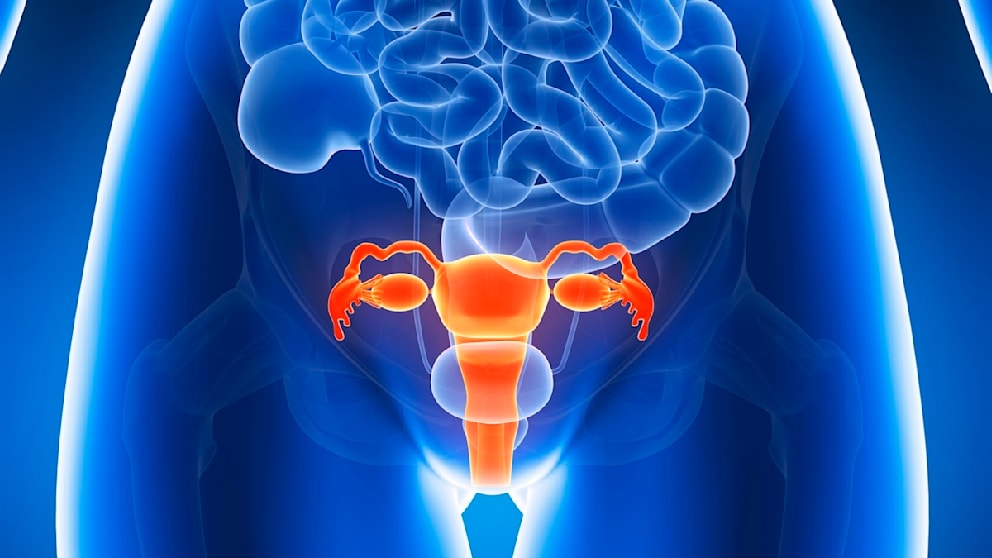 Endometriose verstehen: Einblicke von einer Frauenärztin